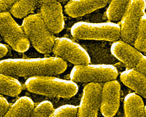 Un médicament antalgique tiré d’une Escherichia coli vient d’être breveté