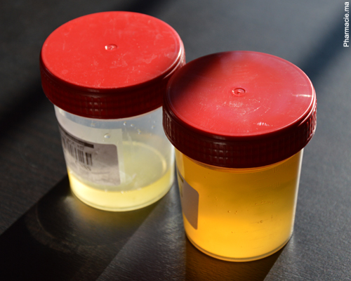 Infections urinaires à répétition : antibiotiques ou pas ?