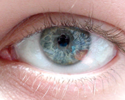 Problèmes oculaires et maux de tête : un lien avéré 