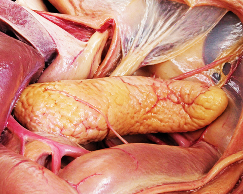 Cancer du pancréas : un nouveau traitement  permettrait de doubler la durée de survie des patients