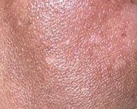 La Côte d’Ivoire interdit les produits de dépigmentation de la peau