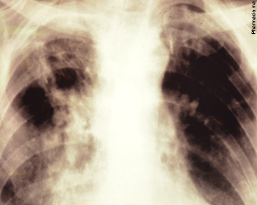 Une hausse des maladies respiratoires en Chine inquiète l'OMS