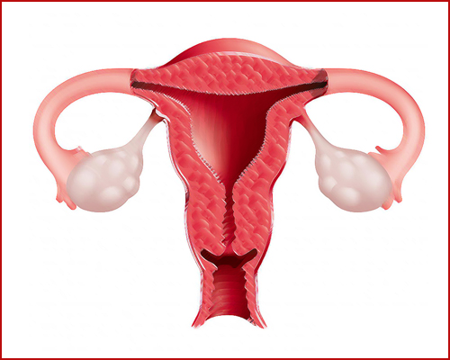 Un nouveau test pour détecter les cancers de l'ovaire et de l'utérus
