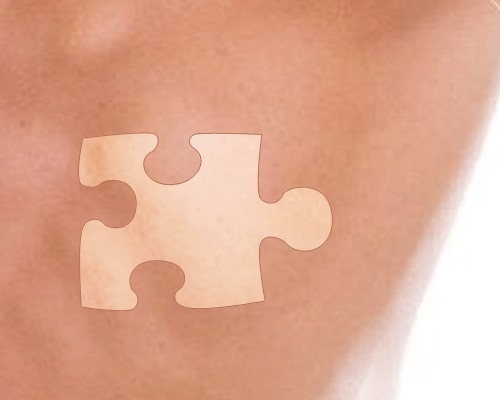 Le vitiligo : une maladie chronique qui éclaircit la peau